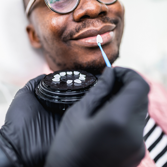 Maplewood cosmetic dentist holding a veneer to a patients smile