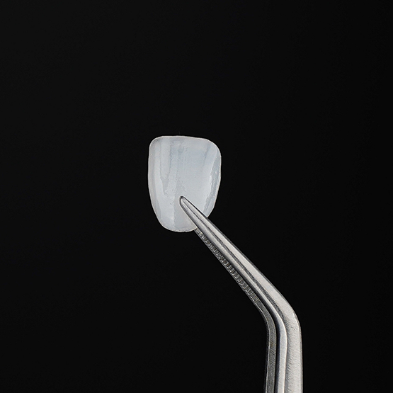 Tweezers holding a white dental veneer