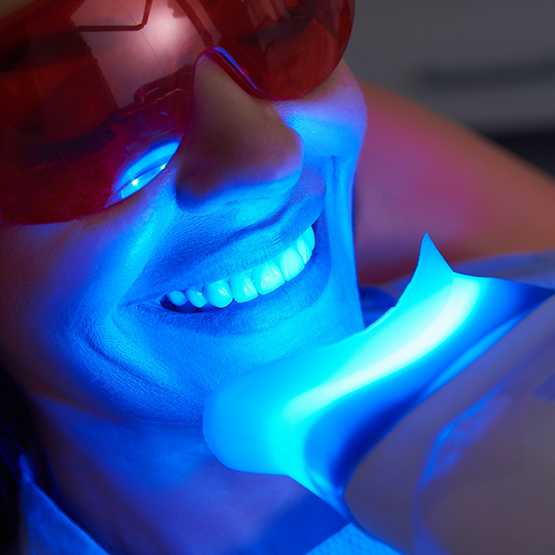 Dental patient getting their teeth professionally whitened