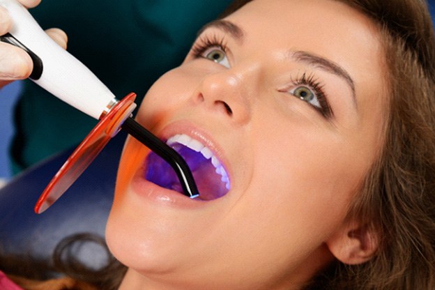 Woman having tooth-colored filling bonded with UV light