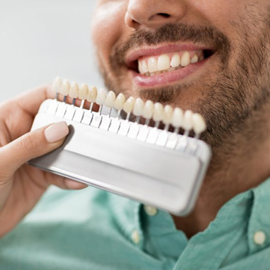 Dentist comparing different veneer shades to a patient’s smile