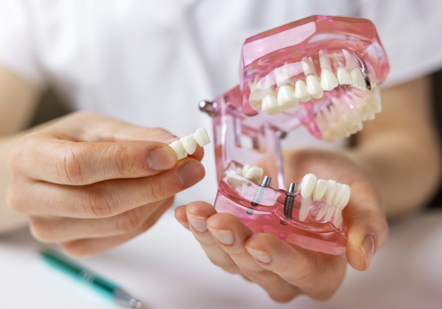 Model denture